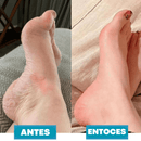 Masajeador de Pies FeetPro™ - Elimina el Dolor y la Hinchazón - Vinolli
